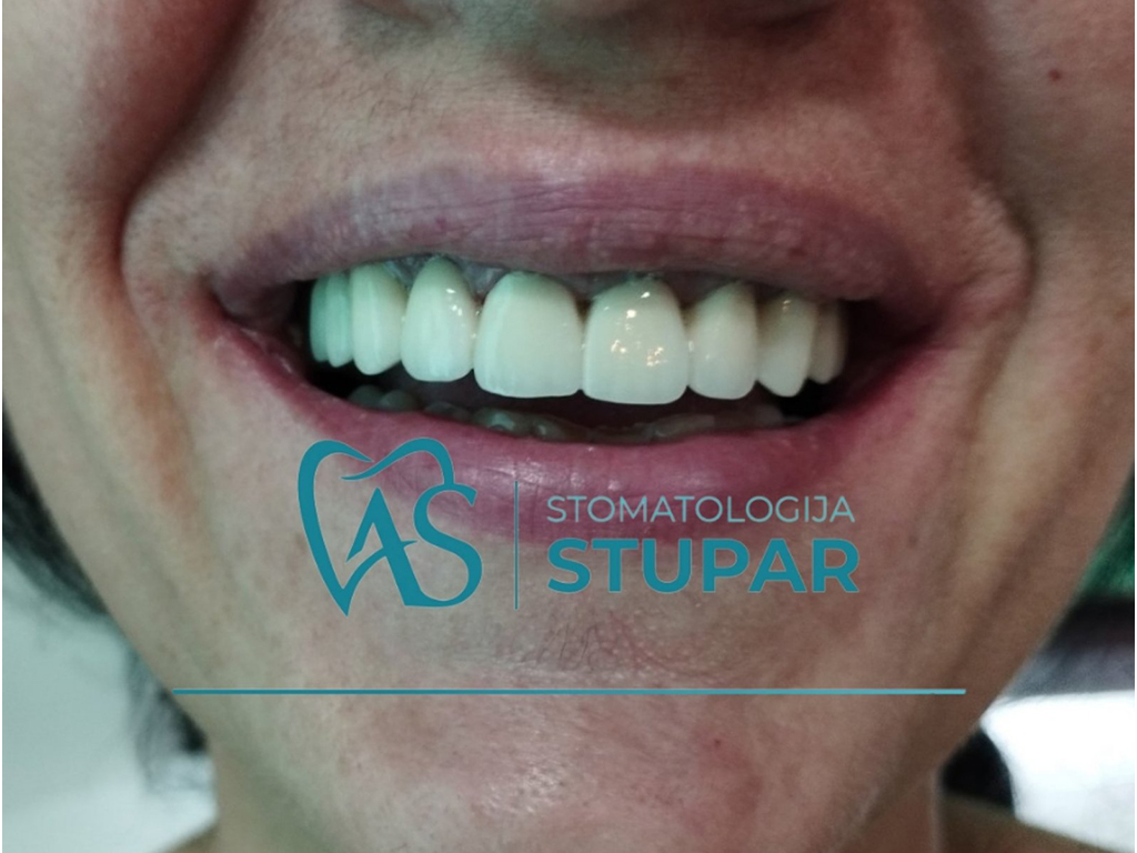 DENTAL OFFICE STUPAR Banja Luka - Photo 8